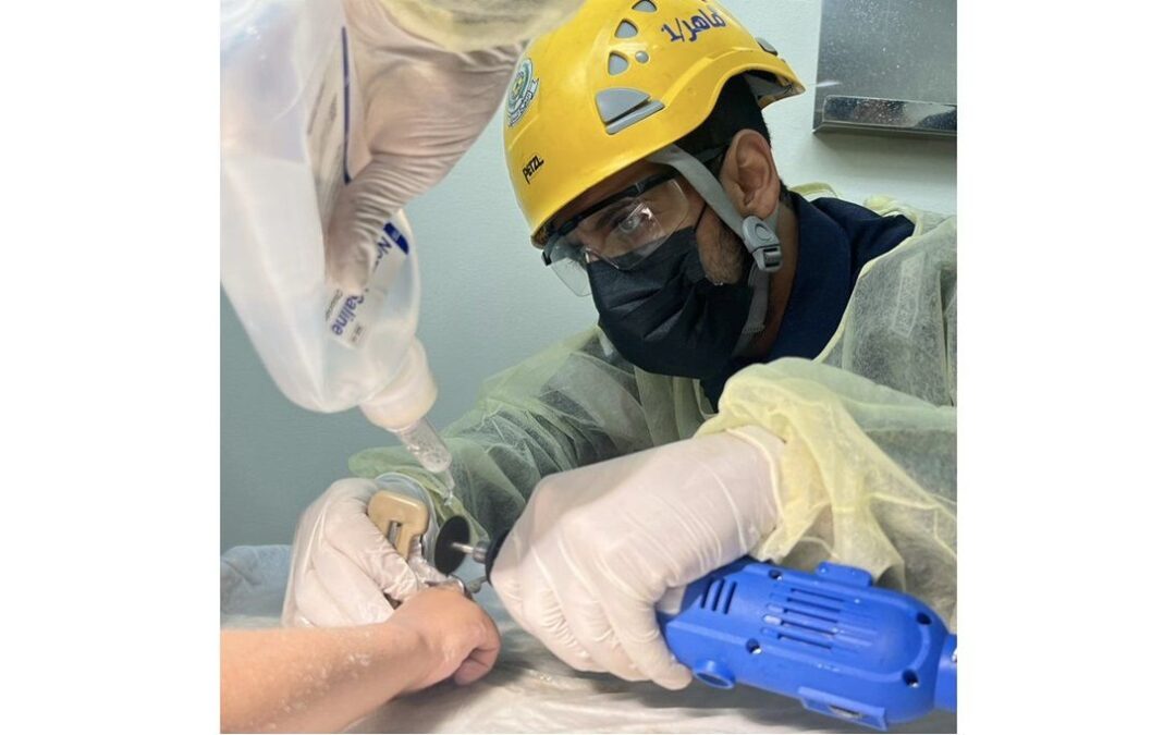 مدني الرياض يفكُّ إصبع مواطن من قطعة معدنية