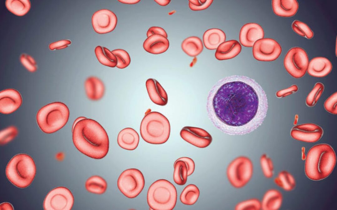 مستشفى الملك سلمان: هذه الأمور تصيبك بفقر الدم ونقص الحديد بالجسم