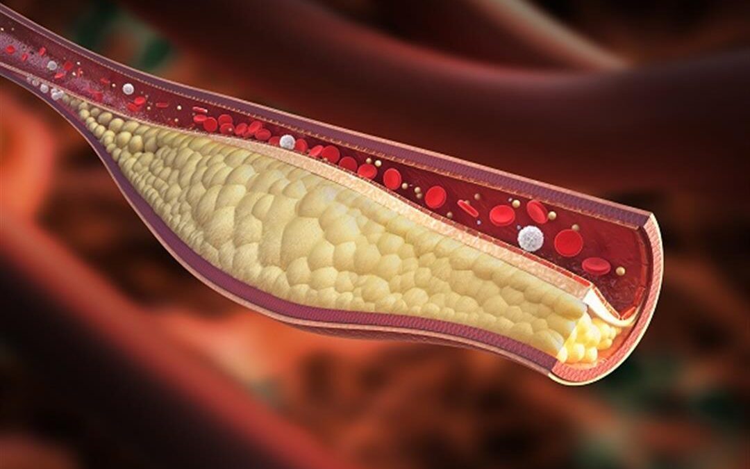 كيفية التحكم في نسبة الكوليسترول بجسمك