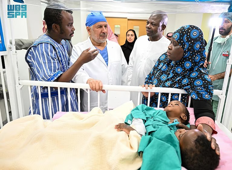 إنفاذاً لتوجيهات خادم الحرمين وولي العهد.. بدء عملية فصل التوأم السيامي البوركيني “حوى وخديجة”