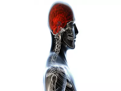 التعرض للهواء الملوث يزيد خطر الإصابة بأورام الدماغ