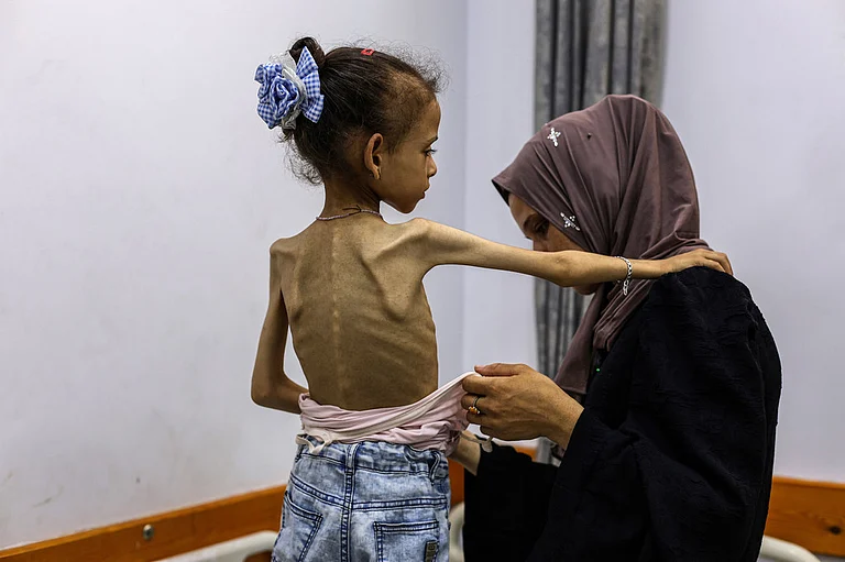 أكثر من 1.2 مليون طفل يعانون انعدام أمن غذائي حاد