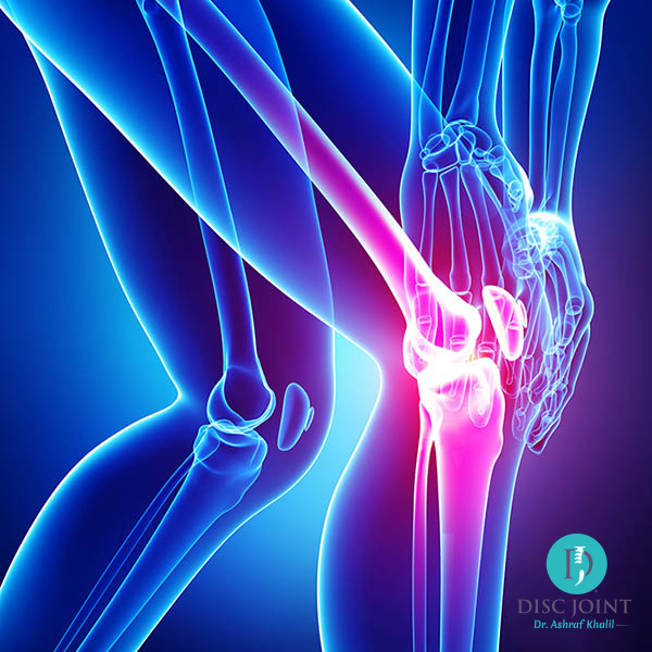 خبيرة روسية: 5 عادات يومية تحمي من ألم المفاصل