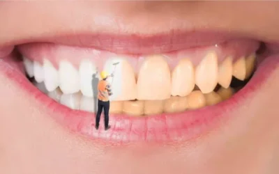 صحة الفم برمضان.. نصائح للوقاية من التسوس ورائحة الفم