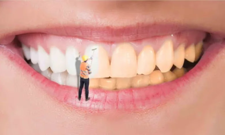 صحة الفم برمضان.. نصائح للوقاية من التسوس ورائحة الفم