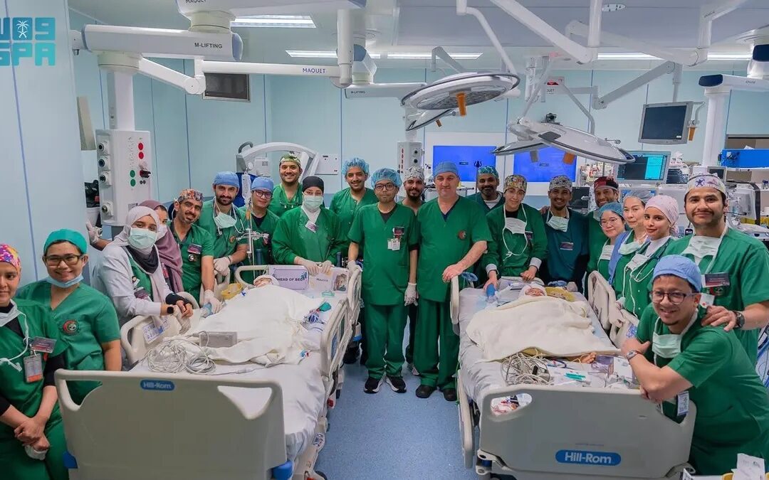 الفريق الطبي والجراحي يستكمل عملية فصل التوأم الملتصق الفلبيني “كليا وموريس آن” بعد عملية جراحية معقدة استغرقت 18 ساعة ونصف الساعة